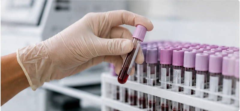 A gloved hand lifting one labeled blood sample from a full rack in the laboratory