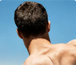 Hair Health — the back of a man's head against a blue sky
